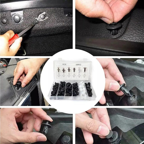 🔧📦 Car Push Retainer Clips & Auto Fasteners Assortment